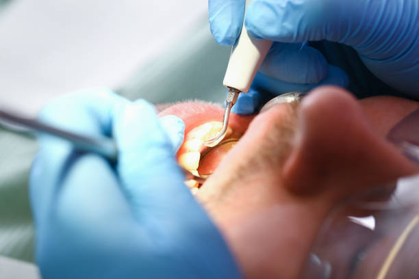 Best Tooth Infection Emergency Dentist  in Rk Forest Village, PA