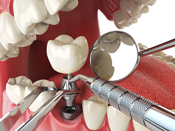 Best Urgent Tooth Repair  in Rk Forest Village, PA